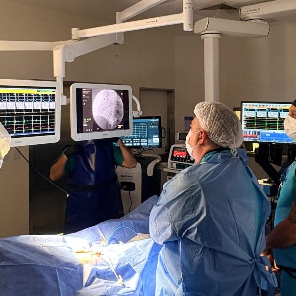 Realizaron por primera vez una crioablación cardíaca en el Hospital Carrillo